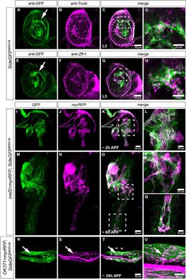 Misregulation of Drosophila Sidestep Leads to Uncontrolled Wiring of the Adult Neuromuscular System and Severe Locomotion Defects